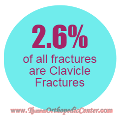 Clavicle Fracture Statistics